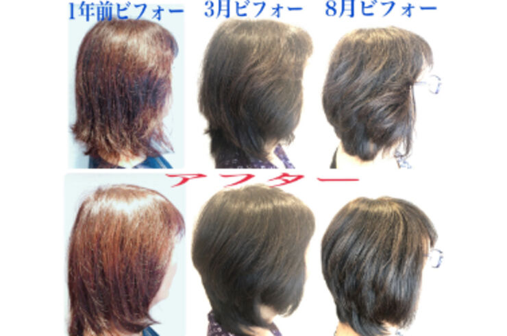 ビフォーアフター