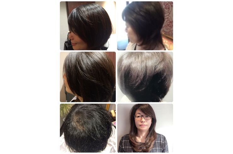 ビフォーアフター